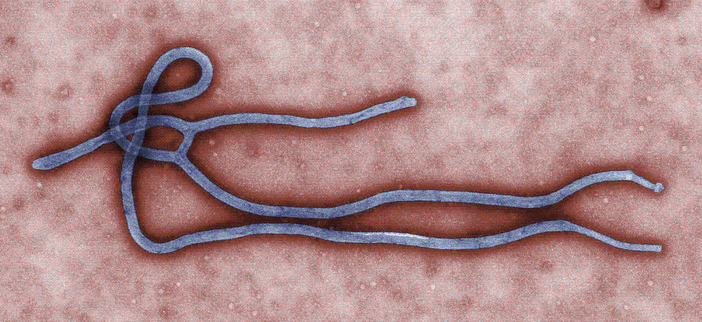 Colorized transmission electron micrograph of a single filamentous Ebola virus virion curled against a pale background