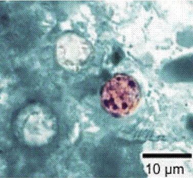 A microscope view of round, stained Cyclospora parasite oocysts against a pale laboratory background.